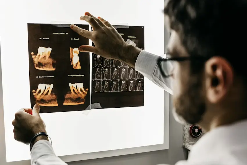 Dentist reviewing dental X-rays with a patient in a modern clinic, illustrating the financial decisions behind dental insurance and discount plans
